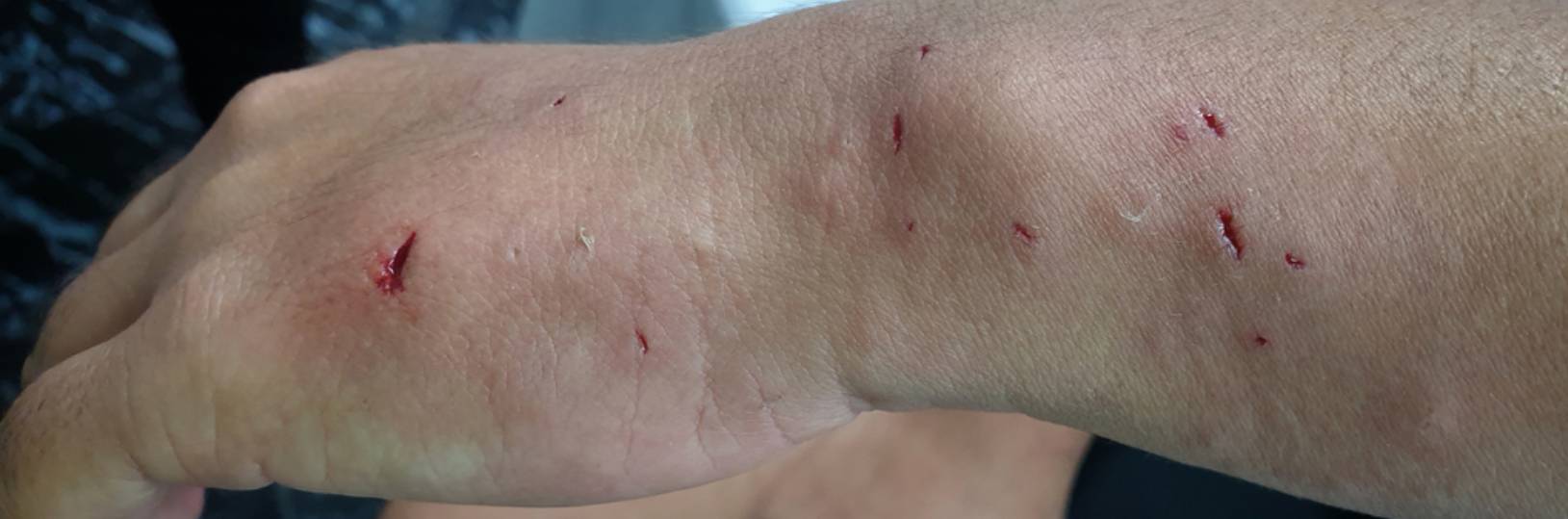 Dog Bite Injuries and Liability in Kentucky: Owner Responsibilities ...